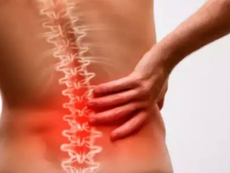 Tratamento de Espondiloartrite em Curitiba