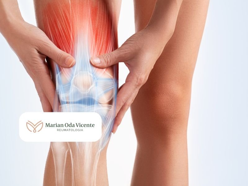 Tratamento para Artrite Reumatoide em Curitiba